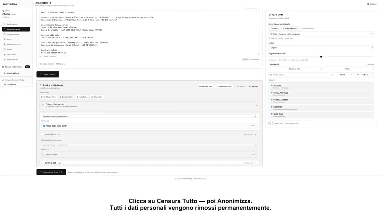 Guarda come funziona
